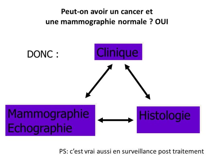 Diapositive13