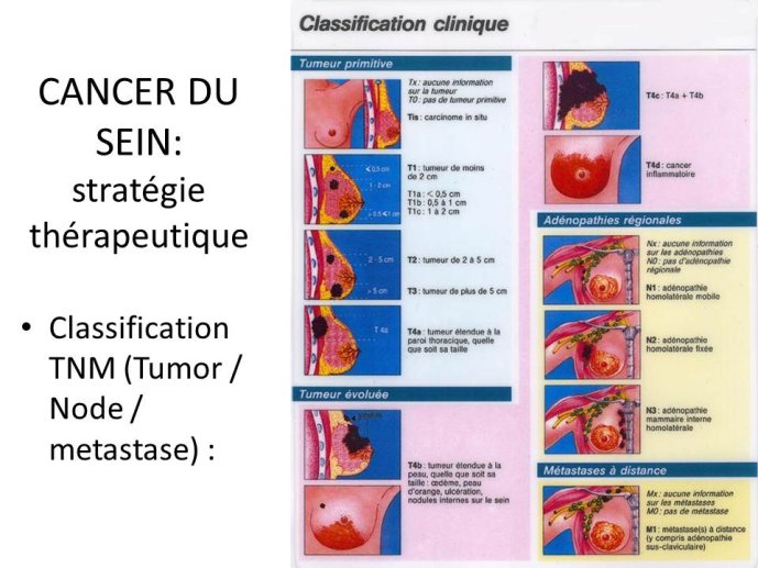 Diapositive4