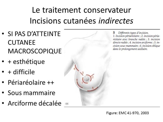 Diapositive11