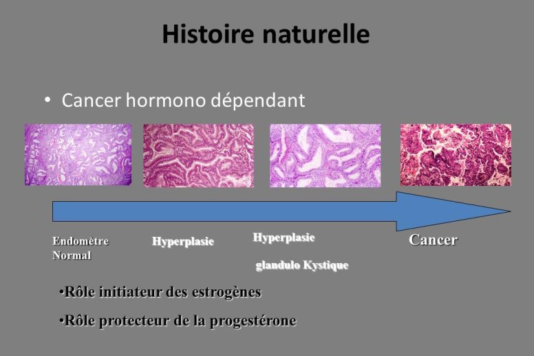 Diapositive13