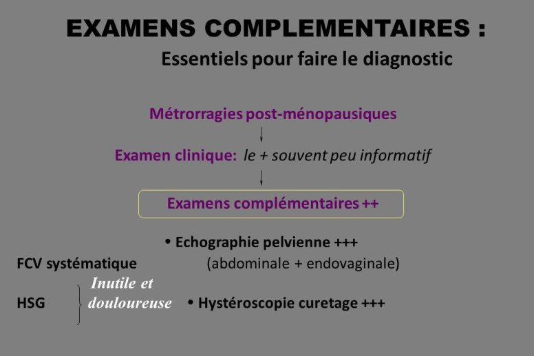 Diapositive20