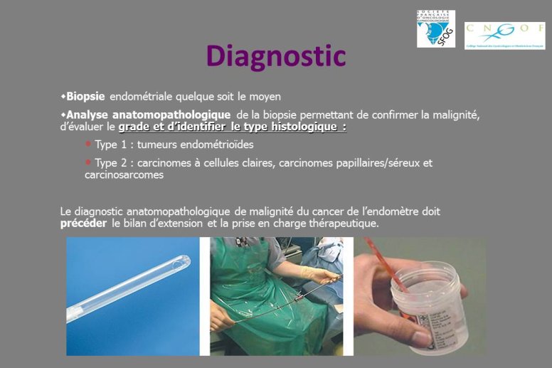 Diapositive22