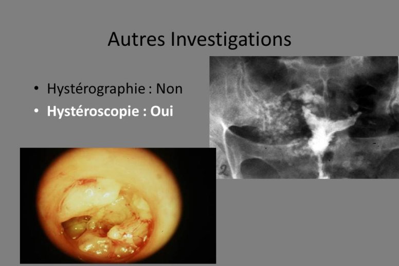 Diapositive35