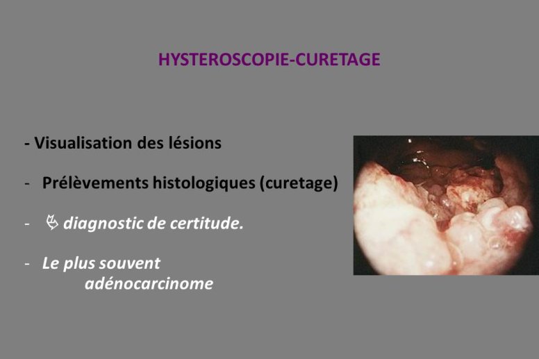 Diapositive36