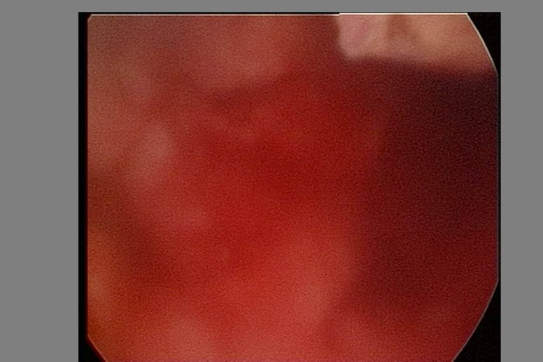 Diapositive38