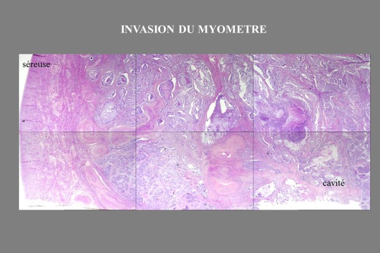 Diapositive41