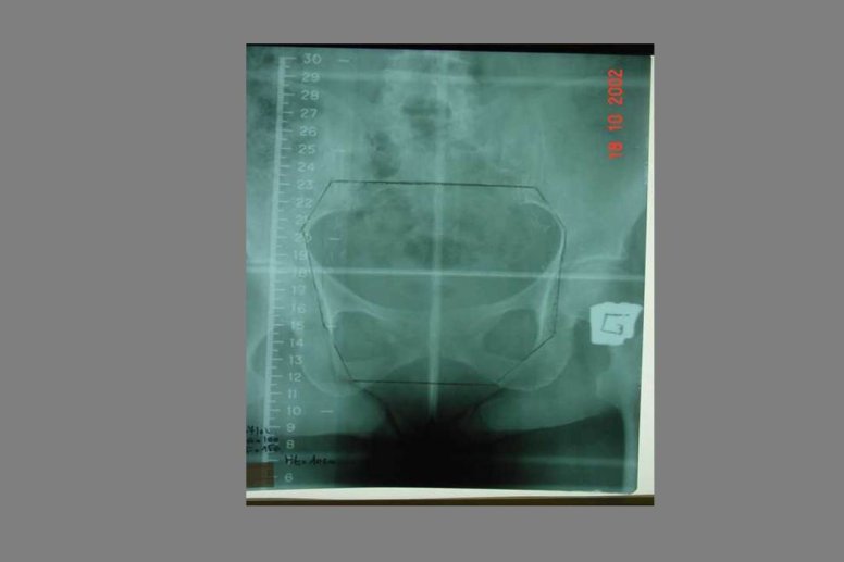 Diapositive99