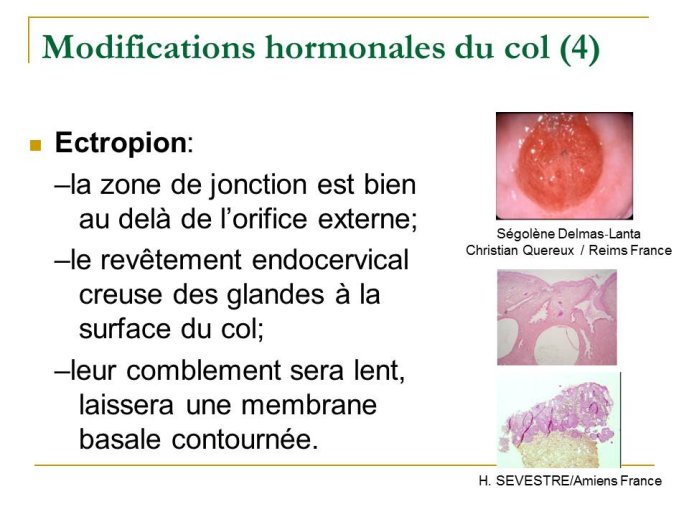 Diapositive27