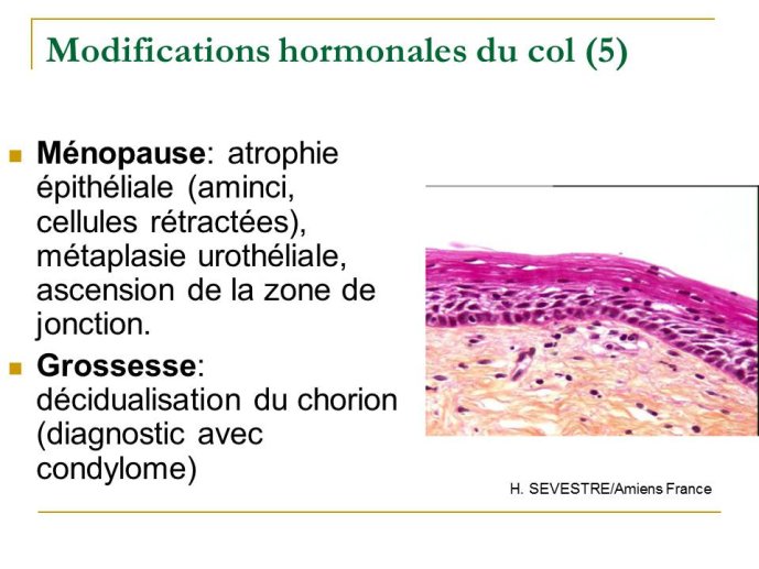 Diapositive28