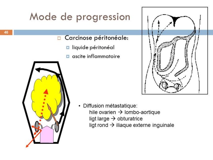 Diapositive46