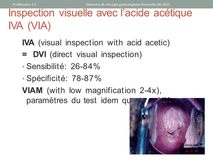 Diapositive54