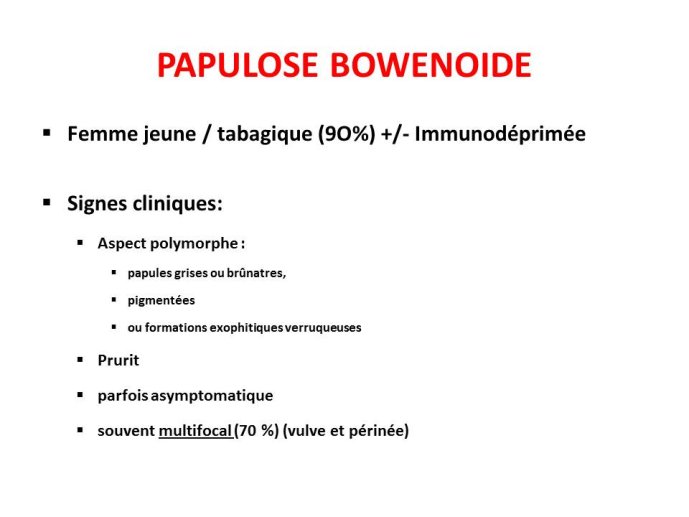 Diapositive32
