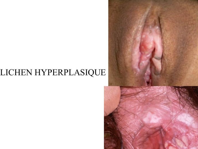 Diapositive45