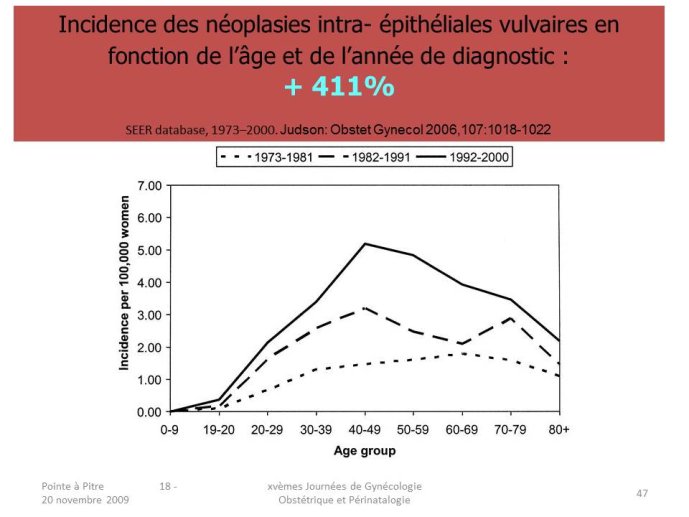 Diapositive47