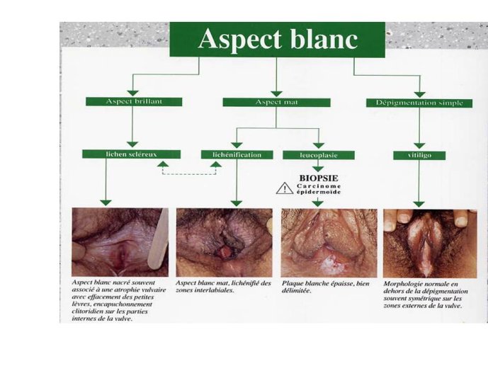 Diapositive51