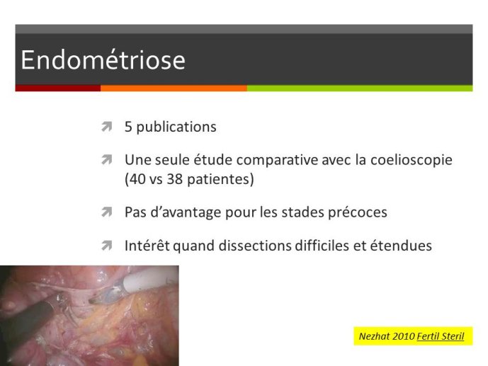Diapositive31