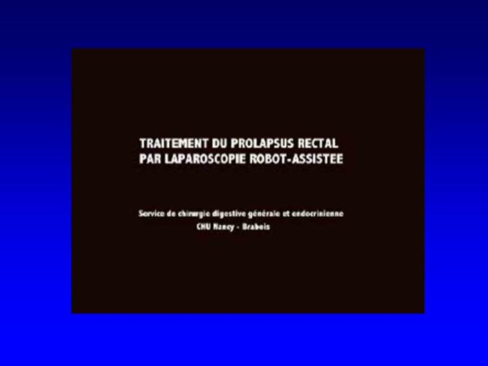 Diapositive64