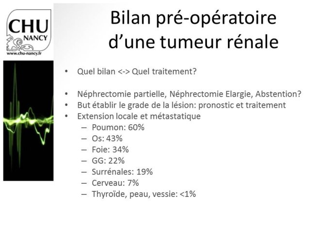 Diapositive10