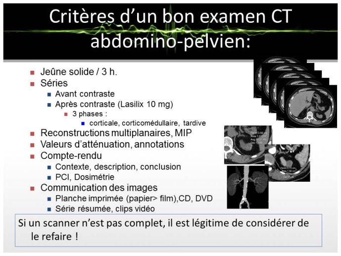 Diapositive13