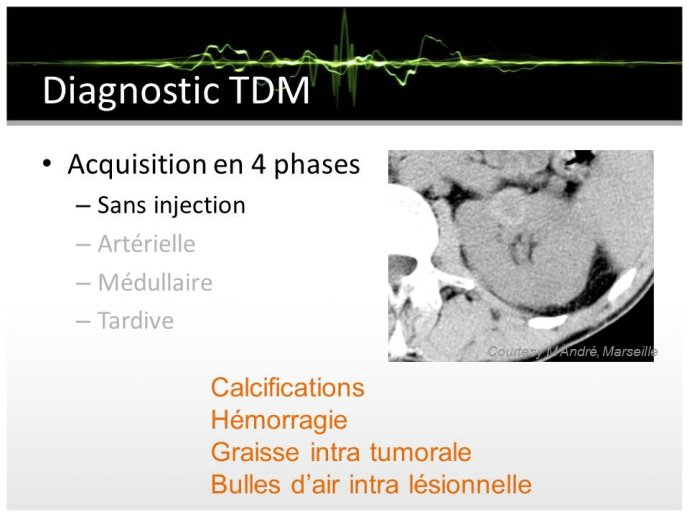 Diapositive14