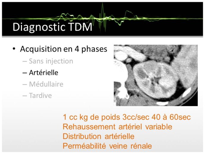 Diapositive15