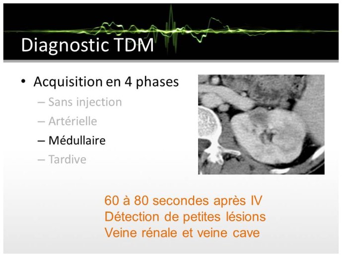 Diapositive16