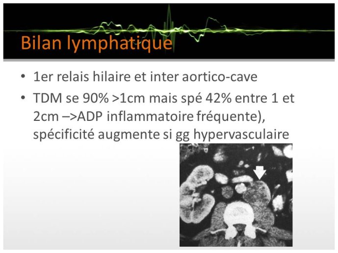 Diapositive27