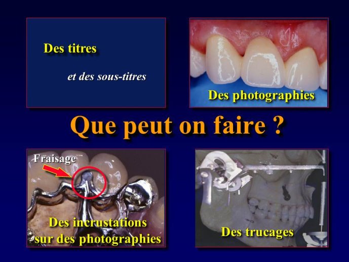 Diapositive4