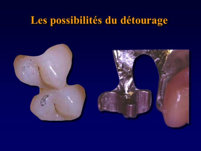 Diapositive41