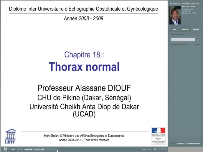 Diapositive32