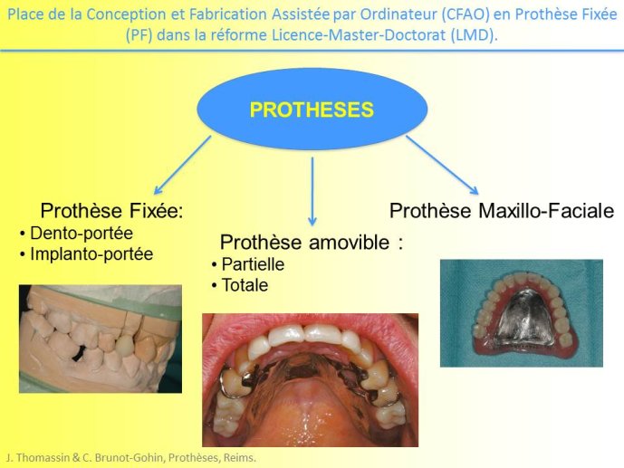 Diapositive3