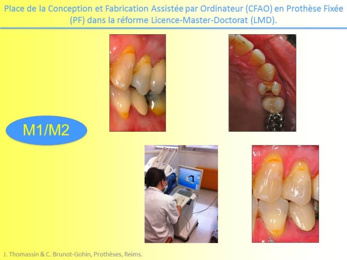 Diapositive11