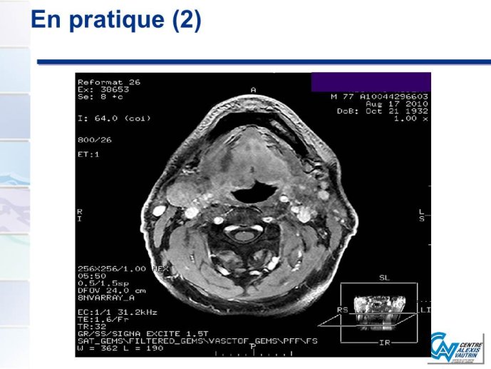 Diapositive15