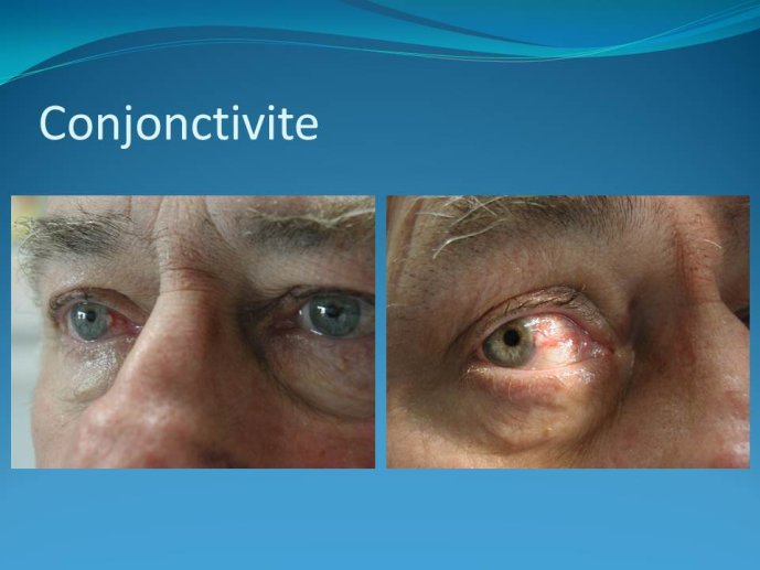 Diapositive25