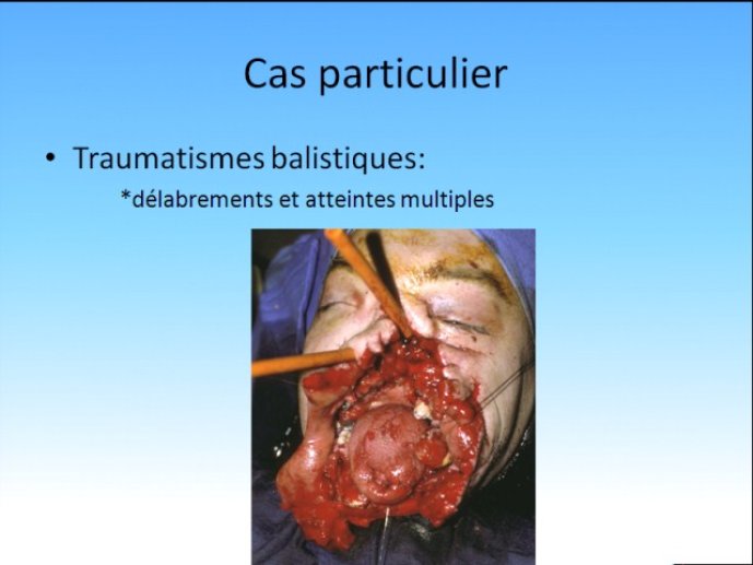diapositive21.jpg