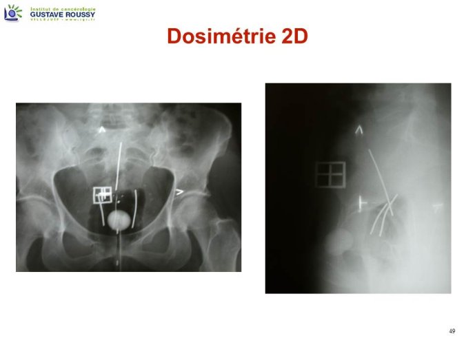 Diapositive49.JPG