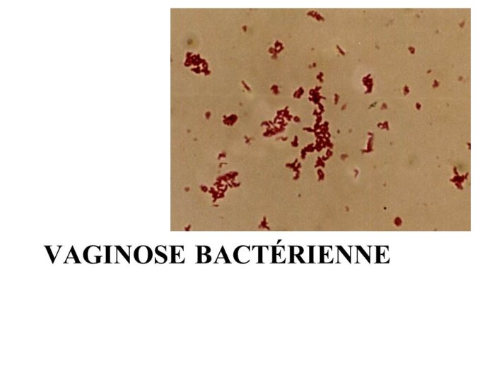 Diapositive29.JPG