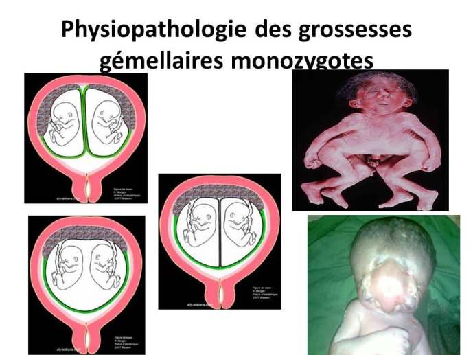 Diapositive14.JPG