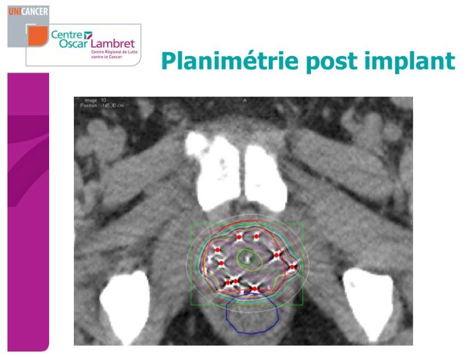 Diapositive97.JPG